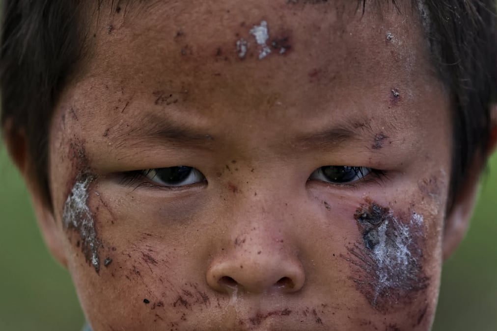 Biswas Tamang, who was found by a schoolteacher after the flood in Betrawati. All photos: SUMAN NEPALI