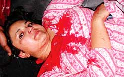 Manjushree’s headache