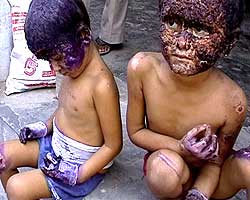 Why the children?