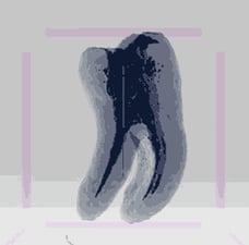Touching raw nerves