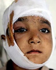 Lessons of Kashmir for Kathmandu