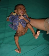 Faulty feeding