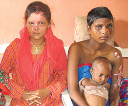 Acid attacks
