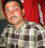Electoral violence