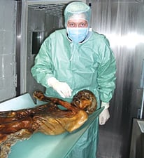 Otzi the Iceman