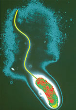 Cholera controversy