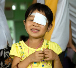Eye health
