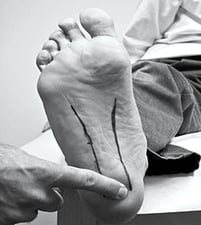 Pain in the sole