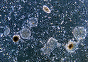 Amazing stem cells