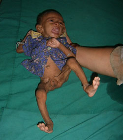 Faulty feeding
