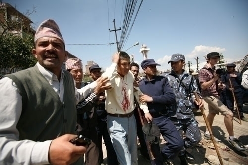 WALKING WOUNDED: A young man injured in the bomb blast at the RPP rally in Baneswor on Monday is helped away by police and members of the public.