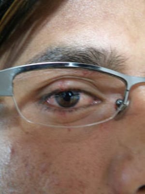 BEFORE OUR EYES: Surendra Sharma, administrative manager of Himalmedia was also attacked by the assailants. His glasses were smashed in, injuring his eye.